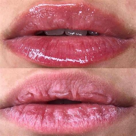 Hidralips | Hidragloss
