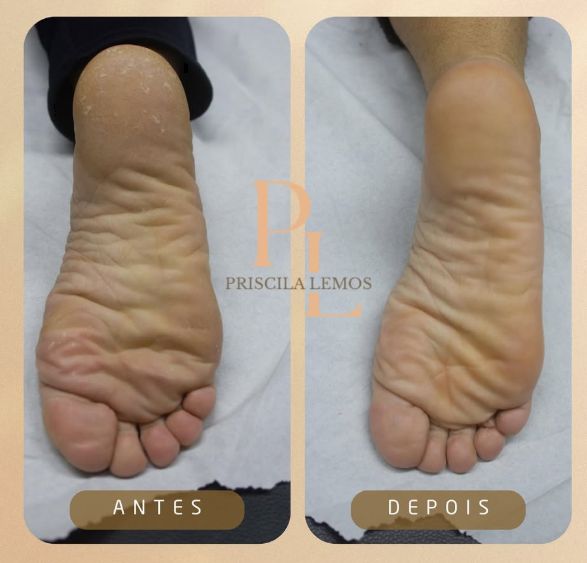 Spa dos Pés